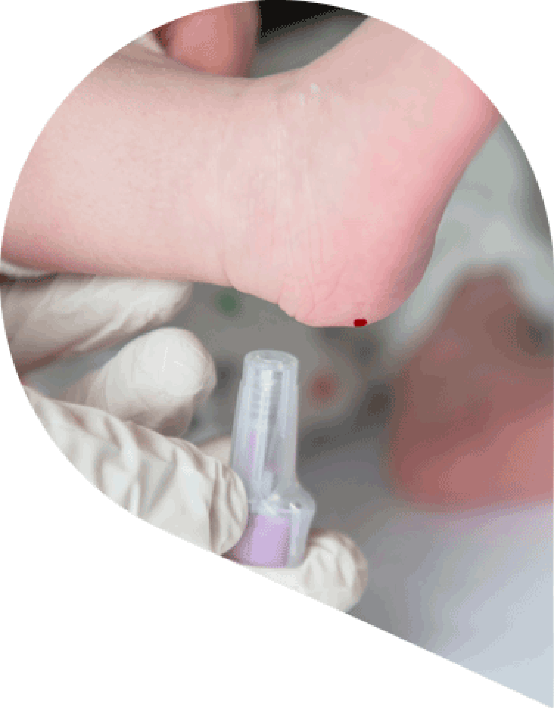 infant having a heel prick test