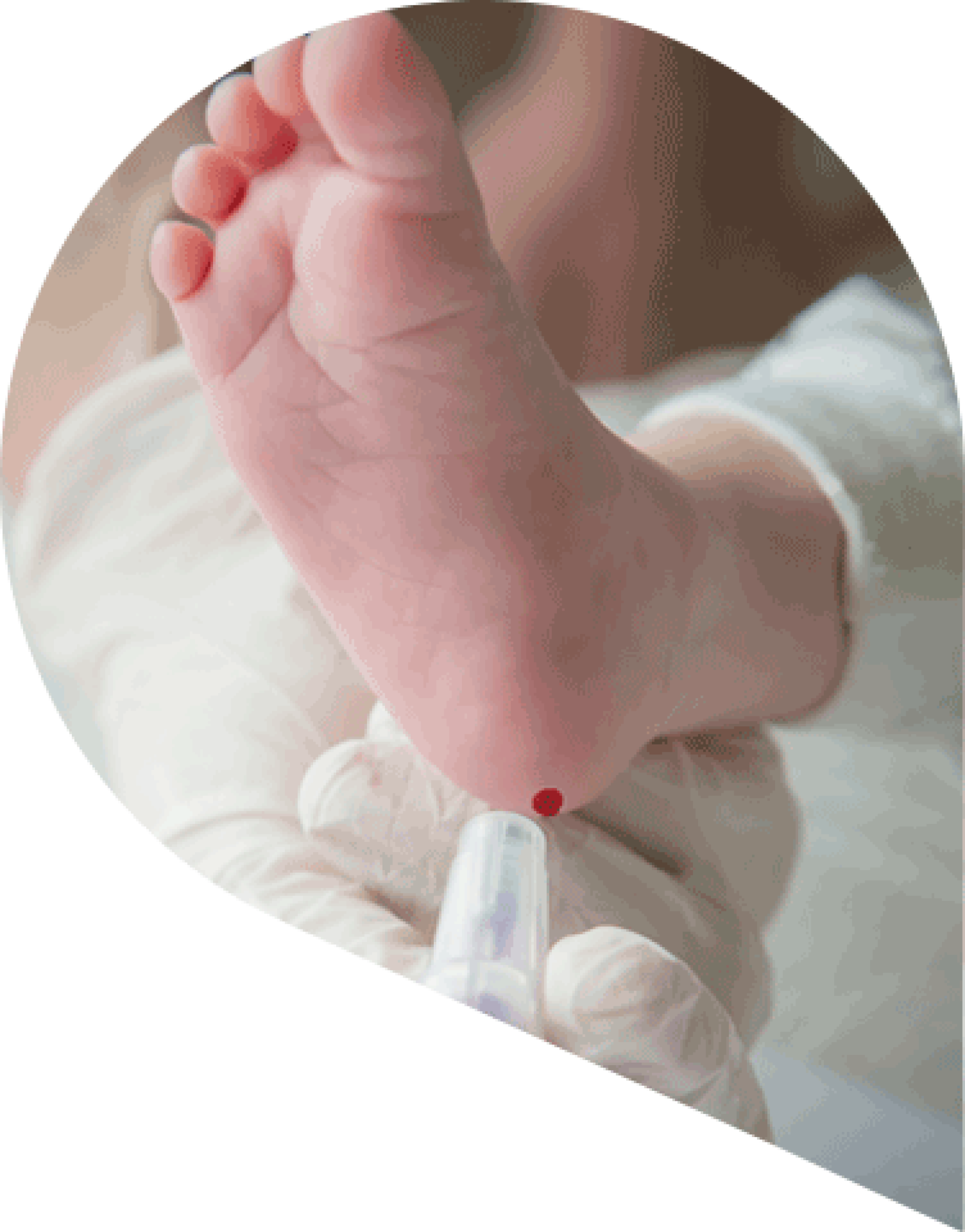 infant having a heel prick test