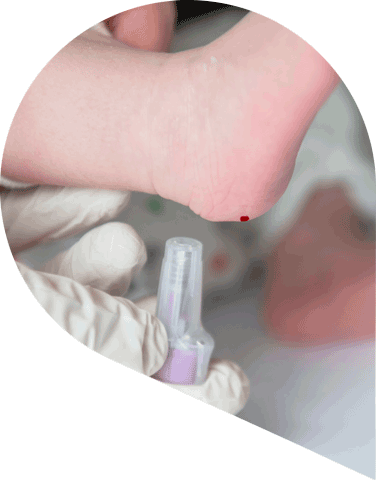 infant having a heel prick test